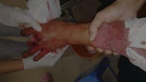 Chủ tịch HĐQT trường Lômônôxốp chém bảo vệ trọng thương - ảnh 4