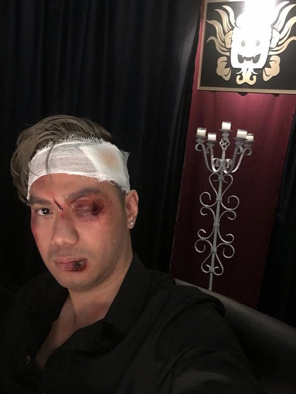 Việt Anh hóa trang be bét máu ở hậu trường 'Người phán xử' ngoại truyện ảnh 1