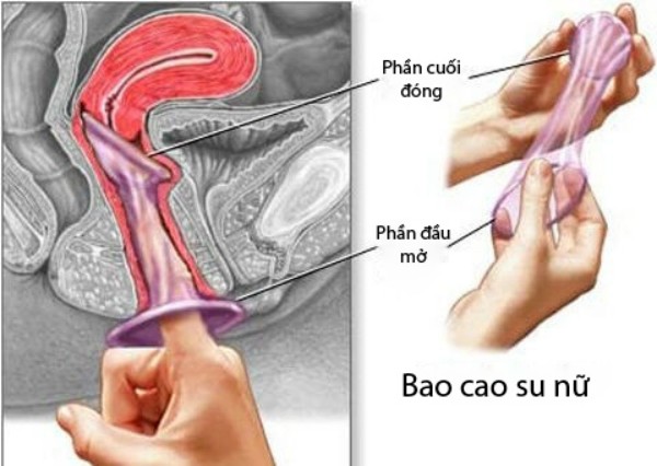 Bao cao su dành cho phái đẹp ảnh 1