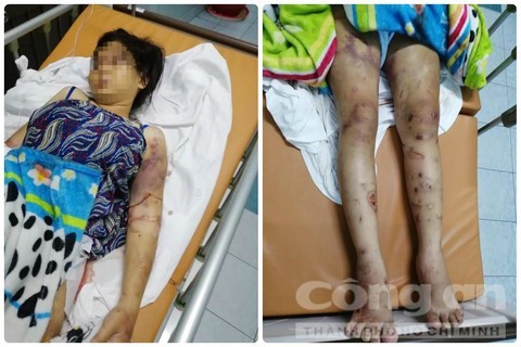 Lời khai của hai anh em ruột tra tấn dã man khiến thai phụ 18 tuổi sinh non tại TP.HCM ảnh 1