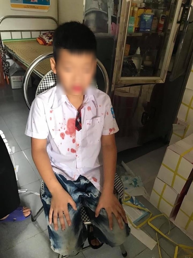 Phụ huynh vào trường hành hung học sinh lớp 1 bị tạm giữ hình sự ảnh 1