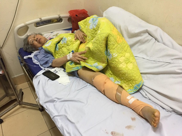 Vụ rơi thang máy ở chung cư B10A Nam Trung Yên: Lời kể bàng hoàng của nhân chứng ảnh 3