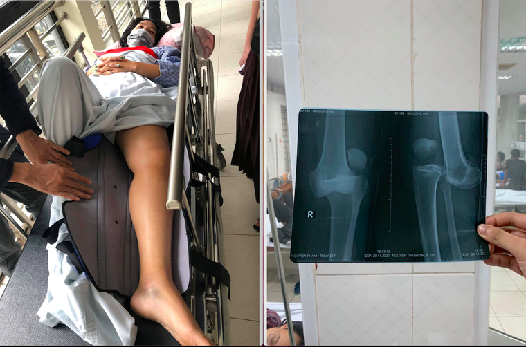 Vụ rơi thang máy ở chung cư B10A Nam Trung Yên: Lời kể bàng hoàng của nhân chứng ảnh 4