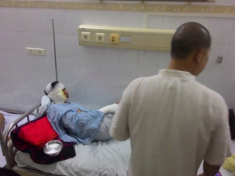 Vụ nổ trạm biến áp: Hai nạn nhân đang nguy kịch ảnh 1