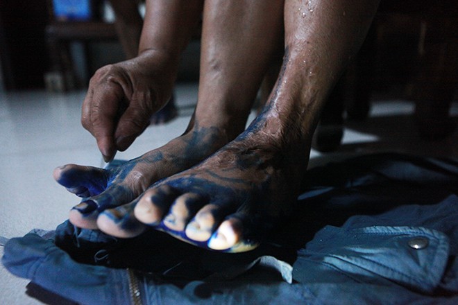 Nước kéo đến đâu, bệnh phát đến đó ảnh 1