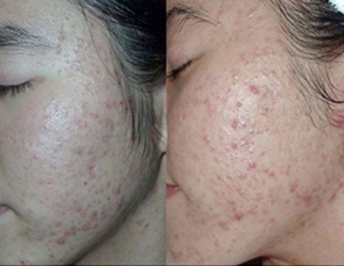 Tham rẻ dùng mỹ phẩm ‘rởm’, chị em lên mạng kêu khóc ảnh 2