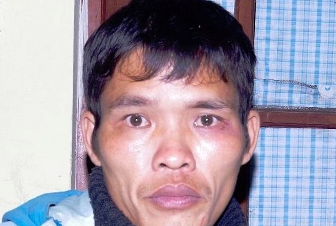 Bắt giữ kẻ dùng gạch đánh chết bạn gái do bị từ chối “quan hệ“ ảnh 1