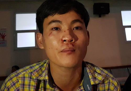 Nạn nhân vụ xe tải 'điên' đâm hàng loạt xe máy: 'Khi tỉnh dậy trong viện mới biết còn sống' ảnh 2