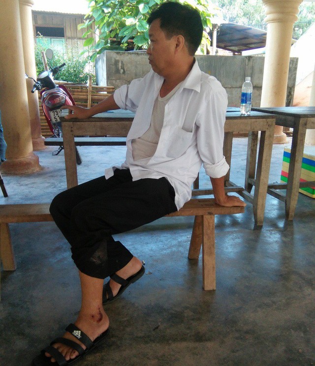 Bắt khỉ đột tấn công công an tại Phong Nha-Kẻ Bàng ảnh 1