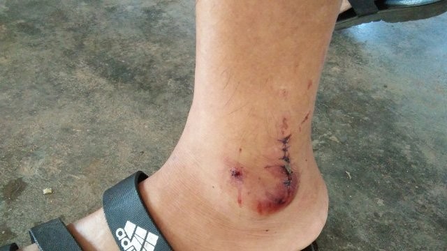 Bắt khỉ đột tấn công công an tại Phong Nha-Kẻ Bàng ảnh 2