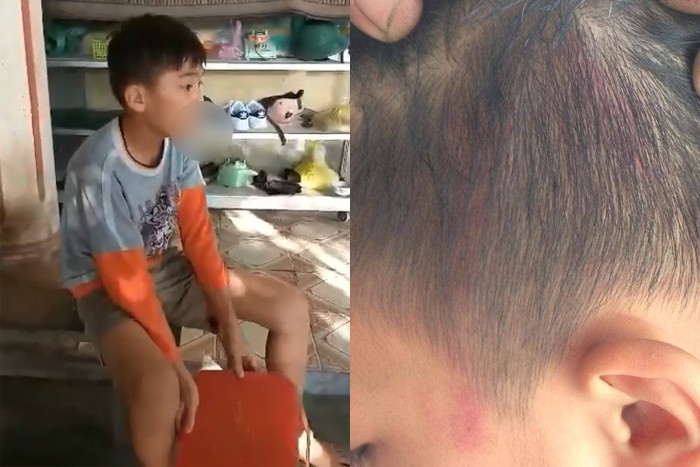 Nam sinh bị ấn đầu vào tường, đập vào giá đỡ bình cứu hỏa: UBND huyện thông tin chính thức ảnh 1