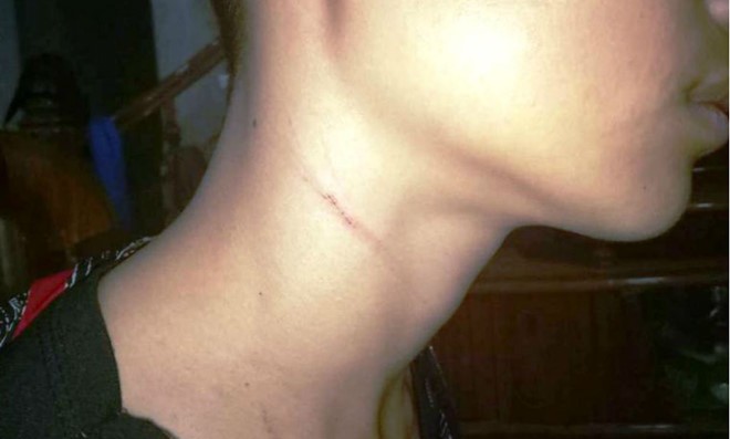 Thanh Hóa: Nam sinh tố cáo bị thầy Hiệu trưởng bóp cổ, dọa giết ảnh 1