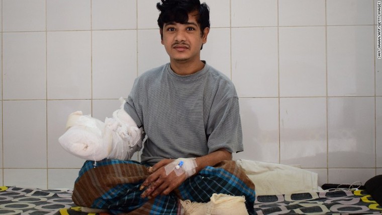 Người cây Bangladesh tiếp tục trải qua phẫu thuật ảnh 1