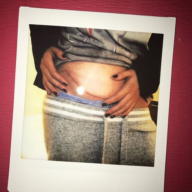 Selena Gomez bí mật mổ ghép thận và danh tính người hiến thận khiến ai cũng phải xúc động! ảnh 1