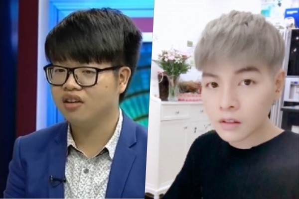 Loạt sao Việt công khai phẫu thuật thẩm mỹ năm 2017 ảnh 1