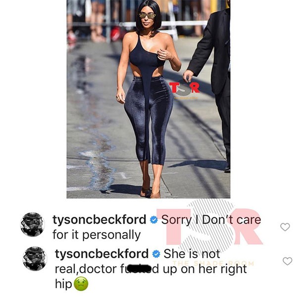 Kim Kardashian bị chế giễu bơm hông bên tròn bên nhọn ảnh 2