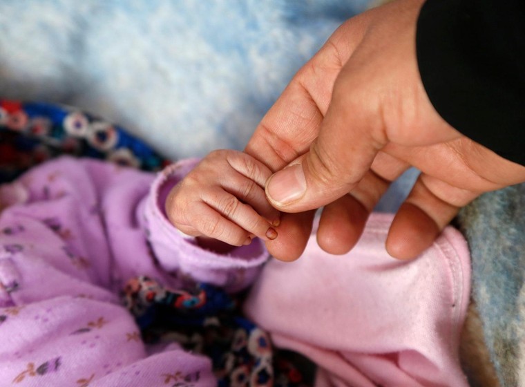 Tình trạng suy dinh dưỡng của trẻ em Yemen ngày càng tồi tệ ảnh 1