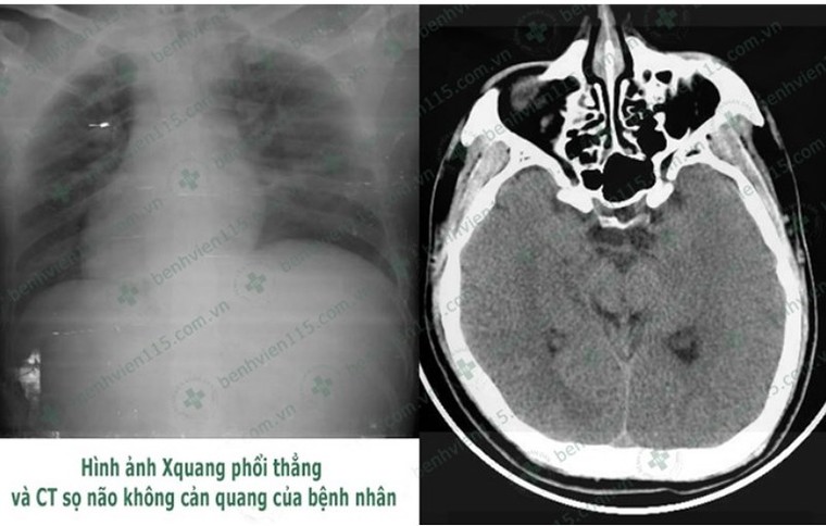 Tài xế hôn mê sâu khi lái xe chỉ vì quên ăn sáng ảnh 1