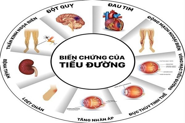 Căn bệnh khiến NSND Anh Tú qua đời gây chết người nhiều thứ 3 Việt Nam ảnh 1