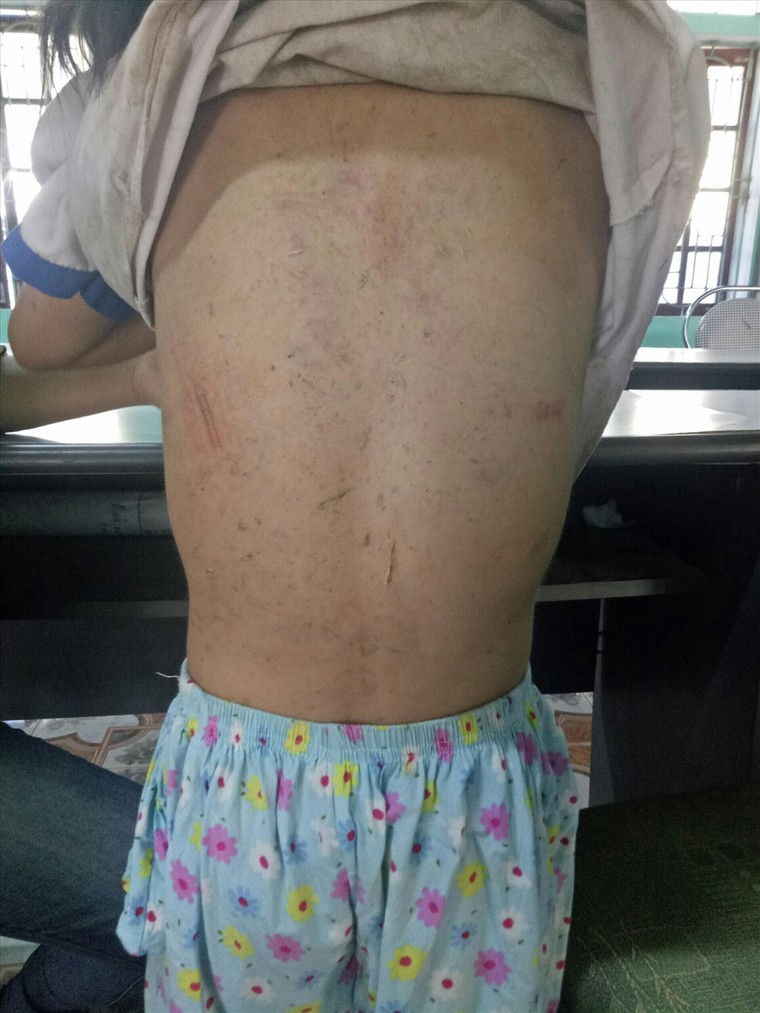 Điều tra nghi án 2 nam sinh lớp 8 xâm hại nữ sinh lớp 2 ảnh 1