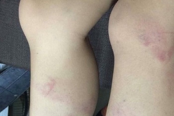 Nhìn lại những hình phạt học trò khiến dư luận bàng hoàng, phẫn nộ ảnh 2