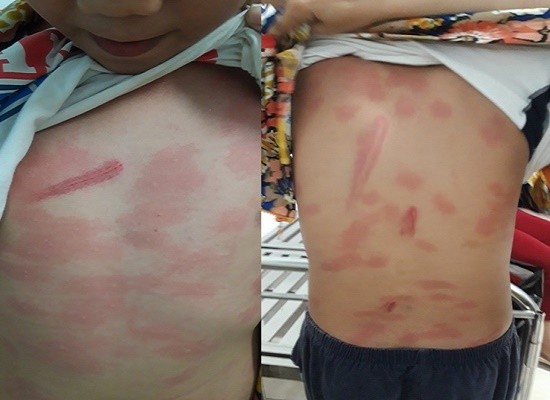 Xác minh vụ bé trai 13 tuổi ở Tiền Giang bị cô ruột bạo hành dã man ảnh 1