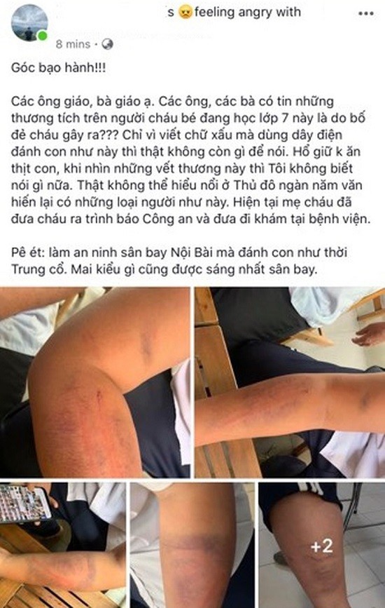 Làm rõ vụ bố dùng dây điện đánh con dã man chỉ vì viết chữ xấu ảnh 1