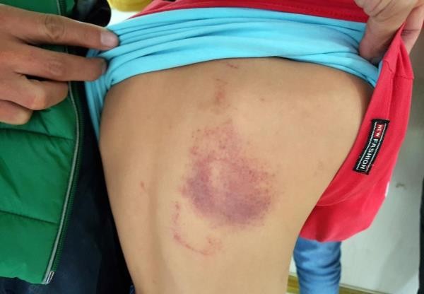 Nhìn lại những vụ giáo viên bạo hành học sinh gây chấn động năm 2019 ảnh 2