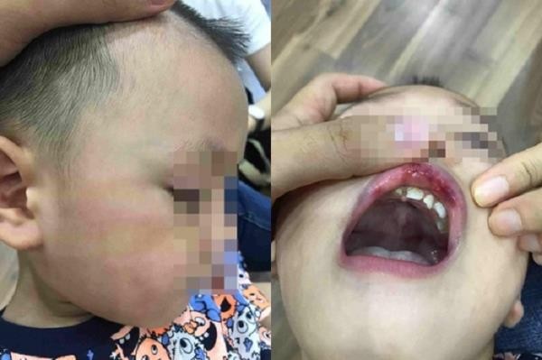 Nhìn lại những vụ giáo viên bạo hành học sinh gây chấn động năm 2019 ảnh 5