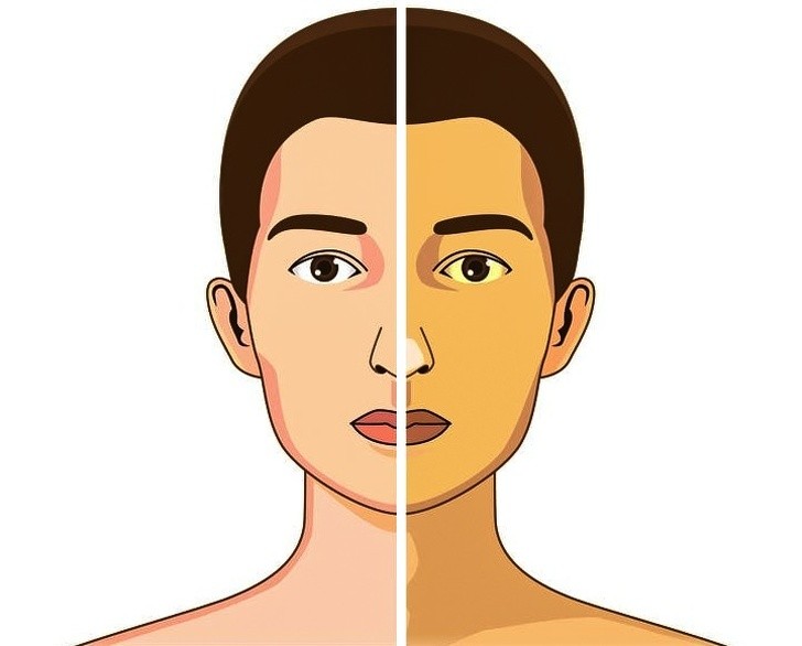 Những dấu hiệu cho thấy cơ thể thiếu vitamin B12 trầm trọng ảnh 3