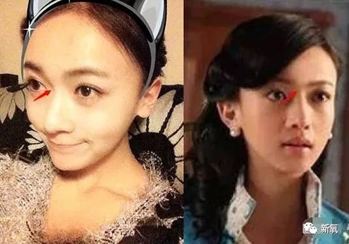 Nữ chính Diên Hi Công Lược dính nghi án phẫu thuật thẩm mỹ - 5