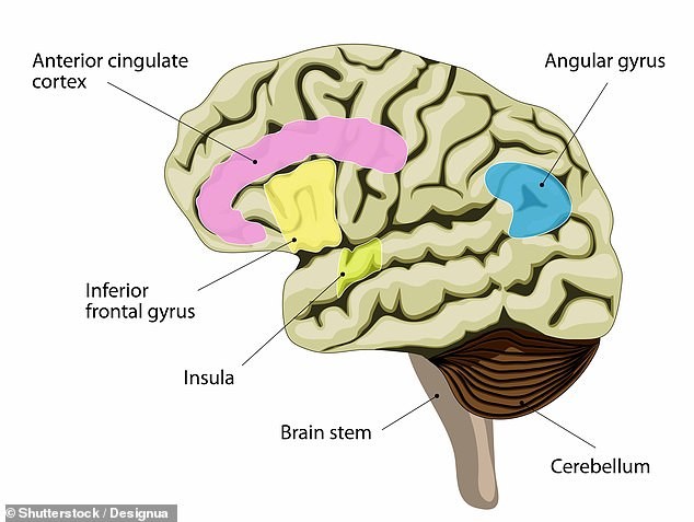 Researchers from Johns Hopkins Hospital in the US found people with schizophrenia had less glutamate and glutathione in the anterior cingulate cortex in their brain (highlighted in pink)
