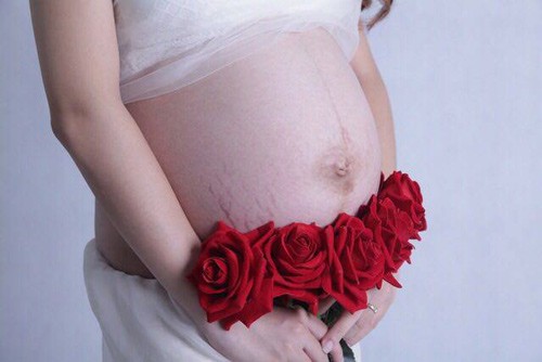 Kỳ diệu: Chị em sinh đôi cùng chuyển dạ một ngày ảnh 12