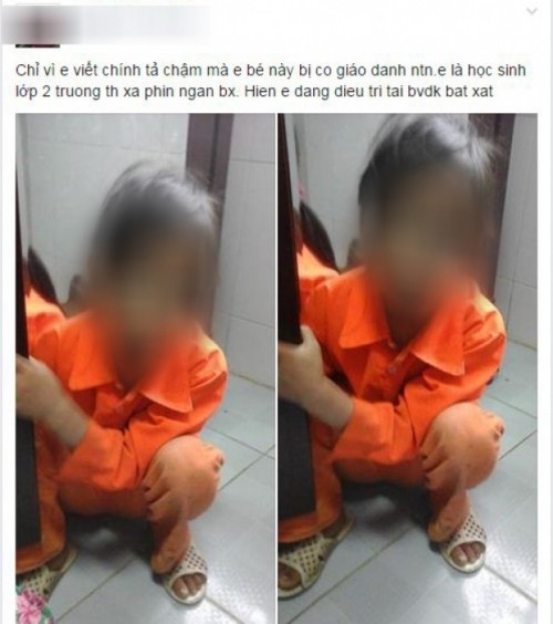 Cô giáo đánh tím mắt bé gái lớp 2 vì viết chậm là ai? ảnh 1