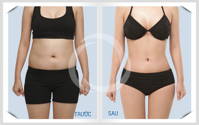 Bí quyết giảm mỡ bụng chuẩn, không biết bạn không thể đạt được ảnh 1