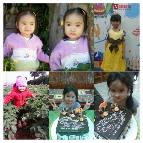 Bé gái xinh như thiên thần bị căn bệnh quái ác hủy hoại khuôn mặt ảnh 1