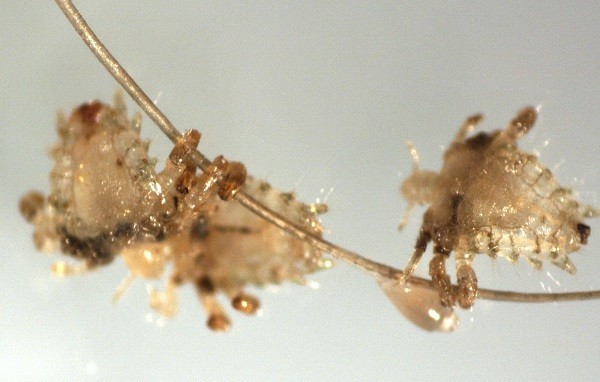 Rùng mình trước sự tái xuất của rận mu ảnh 1