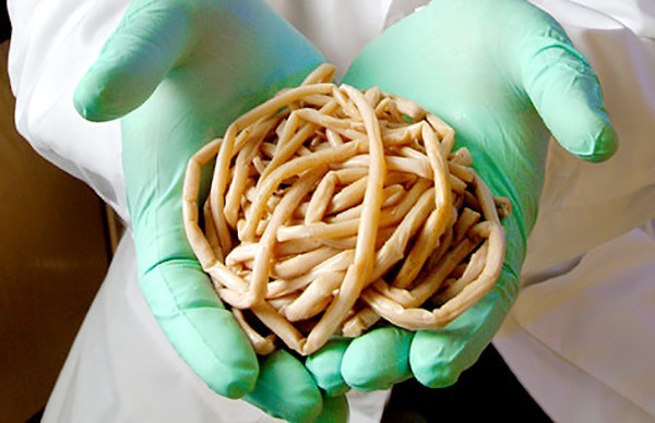 Rùng mình với những loại kí sinh trùng trong cơ thể người ảnh 1