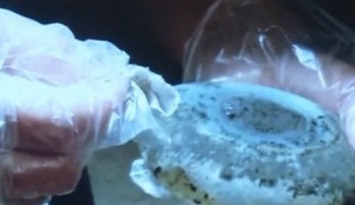 Bé trai 19 tháng suýt chết vì túi silicon độn ngực của mẹ nhiễm nấm ảnh 1