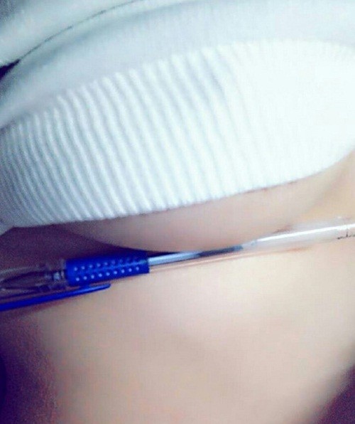 Giới trẻ "phát cuồng" trào lưu lấy ngực kẹp bút bi ảnh 9