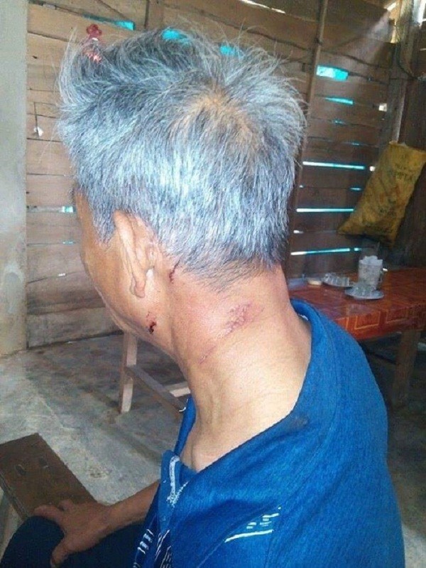 Tin tức mới nhất vụ ‘yêu râu xanh’ uống thuốc sâu tự tử bất thành ảnh 2