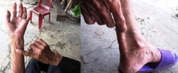 Hãi hùng ngày bị chồng lột đồ, dùng vật nhọn đâm vào vùng kín (2) ảnh 1