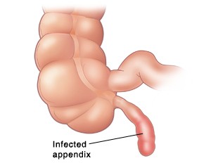 5 bộ phận 'không nên tồn tại' trên cơ thể người ảnh 1