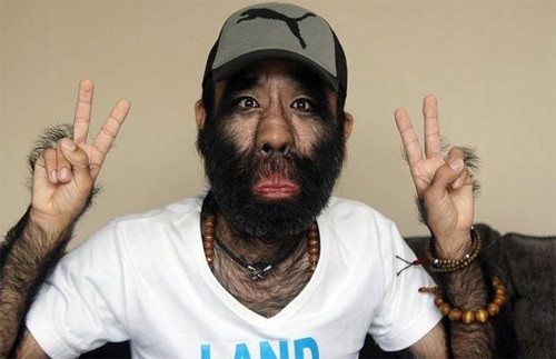 5 bộ phận 'không nên tồn tại' trên cơ thể người ảnh 4