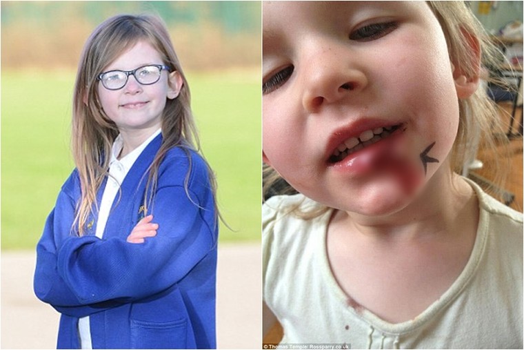 Bé gái bị ô tô đâm, kéo lê dọc đường mà vẫn không thấy đau đớn ảnh 2