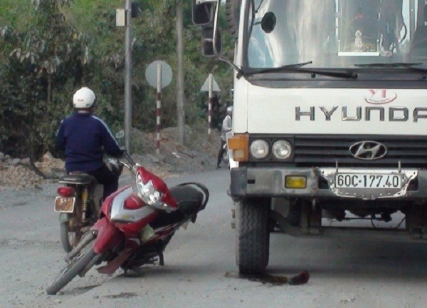 Tránh phần đường thi công, bất ngờ bị xe cán nát chân ảnh 1