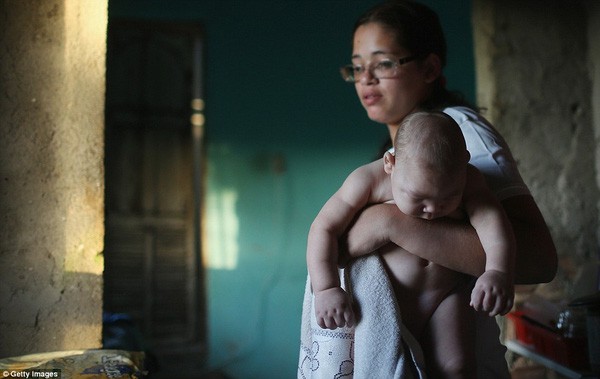 Những bức ảnh khiến bạn ám ảnh về dịch bệnh 'Zika đầu nhỏ' ảnh 4