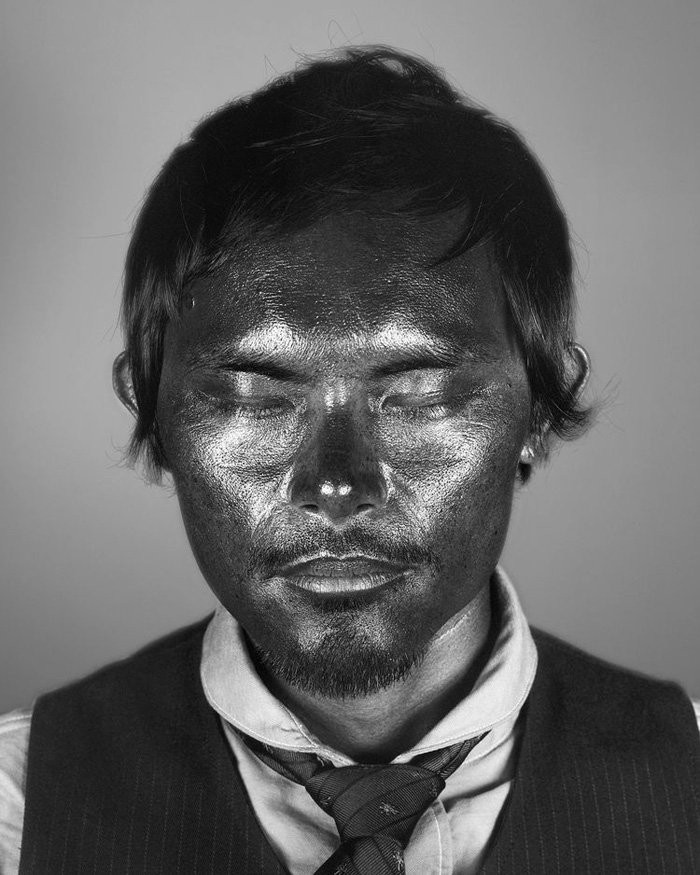 Bộ ảnh gây sốc về tác hại của ánh nắng mặt trời lên da người ảnh 3