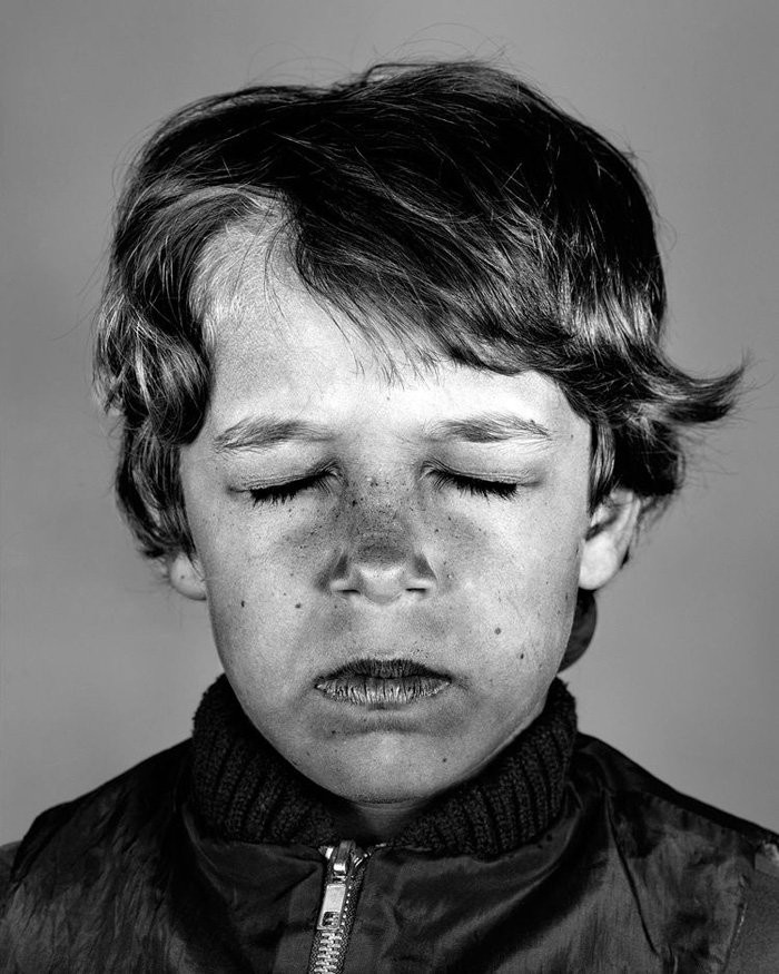 Bộ ảnh gây sốc về tác hại của ánh nắng mặt trời lên da người ảnh 7