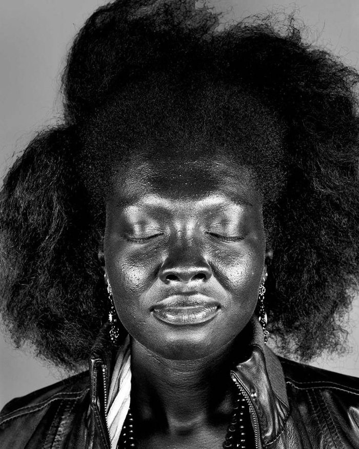 Bộ ảnh gây sốc về tác hại của ánh nắng mặt trời lên da người ảnh 6